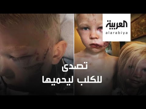 العرب اليوم - طفل بريطاني يواجه كلبًا ضالًا دفاعًا عن شقيقته
