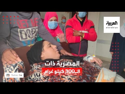  العرب اليوم - شاهد: قصة مصرية تضخم وزنها لـ 300 كيلو غرام