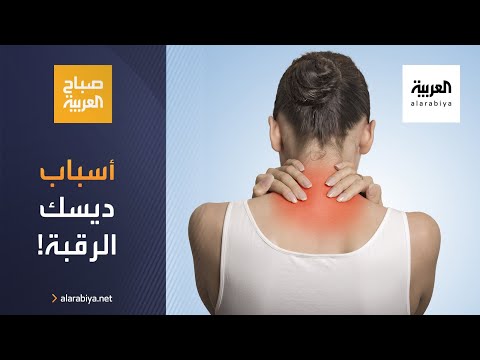  العرب اليوم - شاهد: تعرّف على أسباب ديسك الرقبة وطرق علاجه